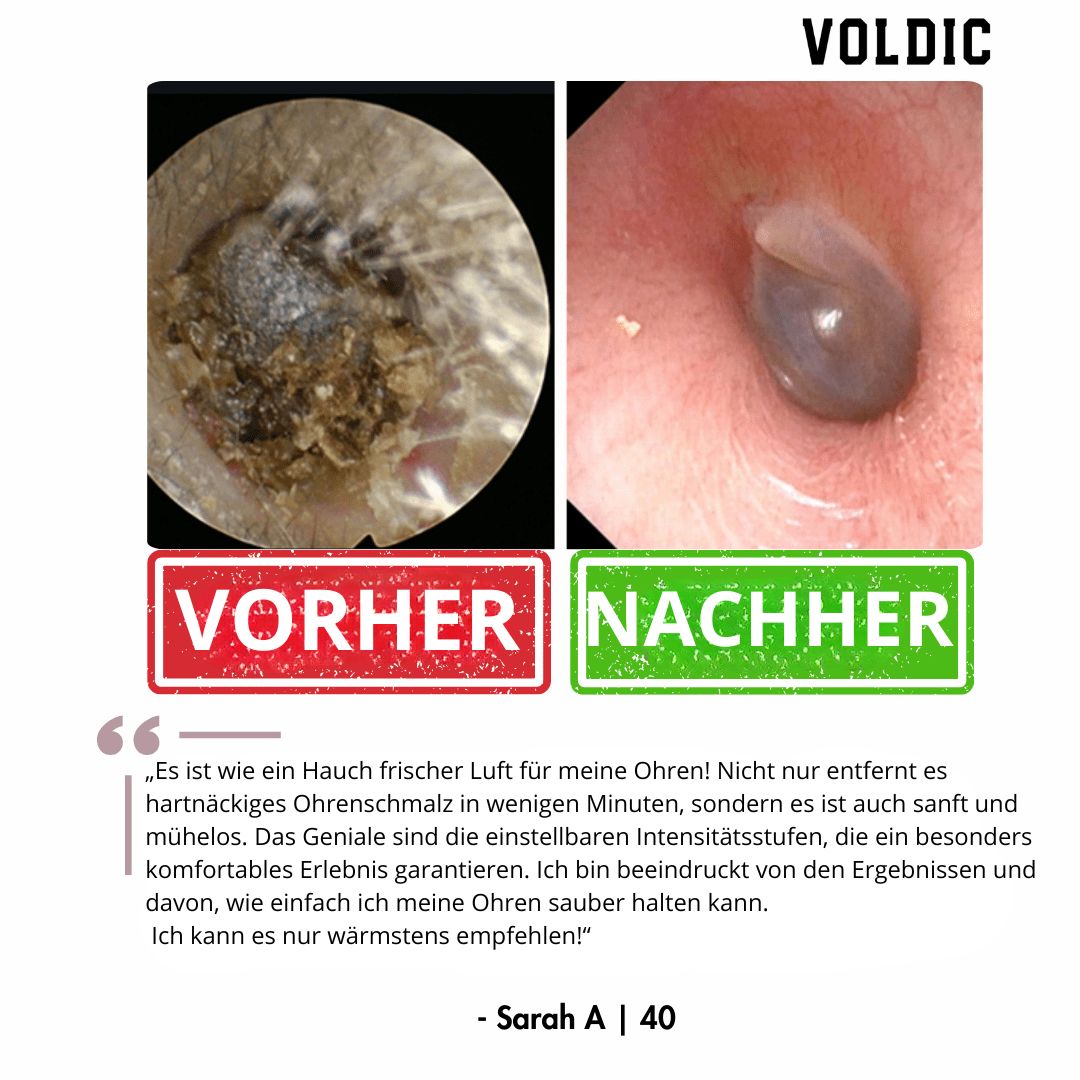 Voldic – Elektrisches Ohrreinigungs‑Set