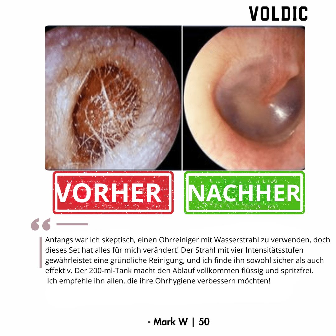 Voldic – Elektrisches Ohrreinigungs‑Set
