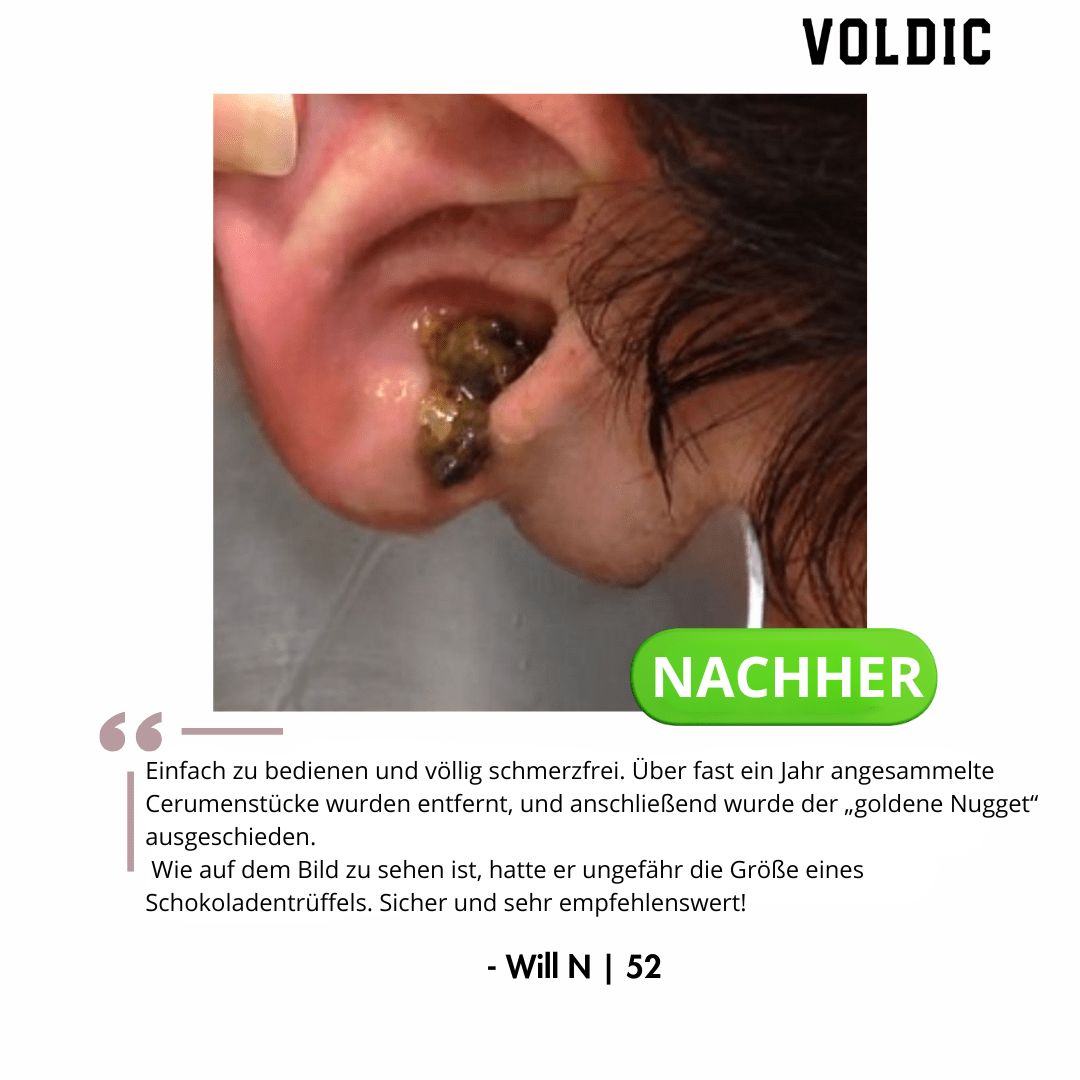 Voldic – Elektrisches Ohrreinigungs‑Set