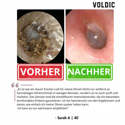 Voldic – Elektrisches Ohrreinigungs‑Set