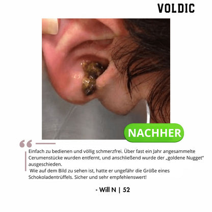 Voldic – Elektrisches Ohrreinigungs‑Set